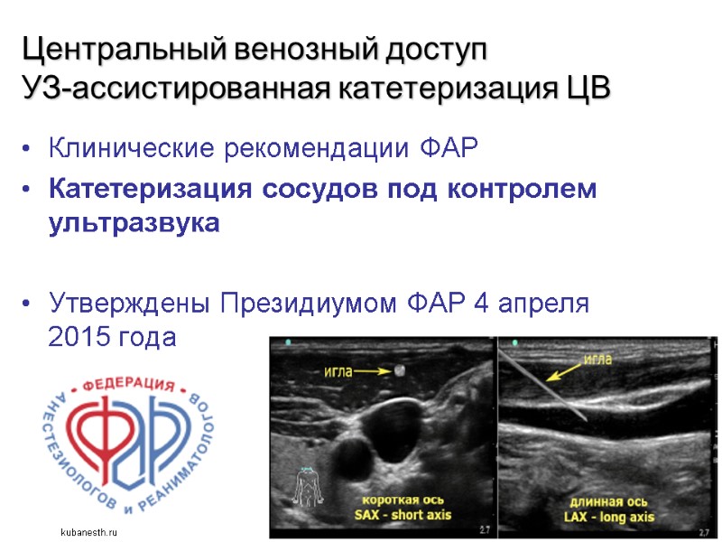 Центральный венозный доступ УЗ-ассистированная катетеризация ЦВ Клинические рекомендации ФАР Катетеризация сосудов под контролем ультразвука